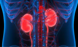 Anatomia nerek z widocznymi naczyniami krwionośnymi. Obraz może sugerować problemy z krążeniem lub zwapnienie nerek.
