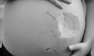 En gravid mage med sprickor som ett äggskal, symboliserar ett tidigt missfall och den bräcklighet som kan följa.