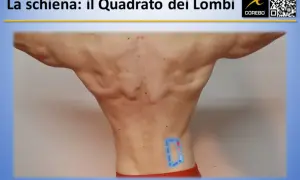 Vista posteriore di un uomo con evidenziate le fasce muscolari schiena, in particolare il quadrato dei lombi.