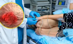 Zbliżenie na komórki raka jelita grubego obok pacjenta podłączonego do aparatury medycznej.