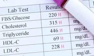 Résultats d'une prise de sang montrant des taux élevés de glucose, cholestérol et triglycérides. Une prise de sang sert à évaluer votre état de santé.