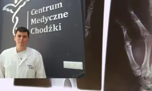 Lekarz w białym fartuchu na tle logo Centrum Medyczne Chodźki i zdjęcia rentgenowskiego dłoni.