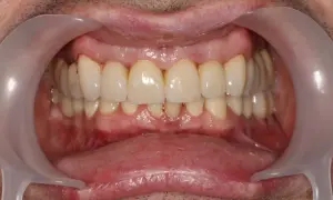 Zdrowe dziąsła i zęby to podstawa. Dowiedz się, czym jest periodontologia i jak dbać o piękny uśmiech.
