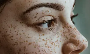 Zbliżenie na twarz z licznymi piegami, które przypominają naturalne piegi henna.