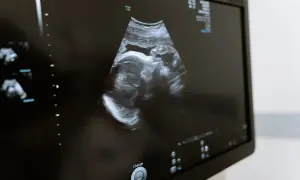 Obraz USG z widocznym profilem dziecka. To ważne badania prenatalne 1 trymestr, które pozwalają ocenić rozwój malucha.