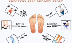 Centralnie umieszczona stopa ludzka, otoczona ikonami ilustrującymi przyczyny deformacji stóp: otyłość, obciążenie siłowe, wysokie obcasy, brak ruchu, genetyka i źle dopasowane obuwie.