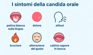 Sintomi della candida orale: patina bianca sulla lingua, dolore, alitosi, bruciore, alterazione del gusto, sapore cattivo in bocca.