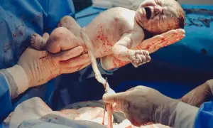 Nowy człowiek na świecie! Cesarskie cięcie trwa krótko, a ten noworodek już jest trzymany przez lekarza.