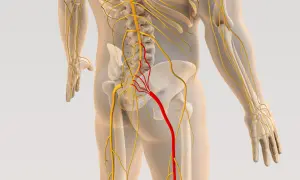 Anatomia układu nerwowego, z zaznaczonym na czerwono nerwem, który może być objęty dyskopatią lędźwiową.