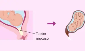Ilustración muestra un bebé en el útero y el tapón mucoso, seguido de un bebé listo para nacer.
