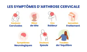 Illustrations des symptômes de l'arthrose cervicale : douleurs cervicales, maux de tête, cou raideur, sensation frottement, symptômes neurologiques, douleurs épaule, troubles équilibre.