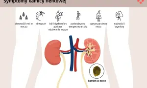 Diagnostyka kamicy nerkowej: Jakie badania i co oznaczają?
