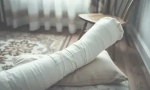 Kiedy gips jest za luźny? Objawy i co zrobić, by uniknąć komplikacji