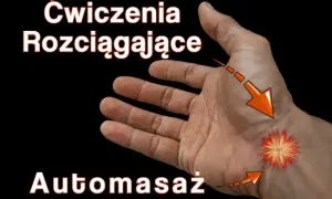 Rehabilitacja po cieśni nadgarstka: Kiedy zacząć ćwiczenia? Ekspert radzi
