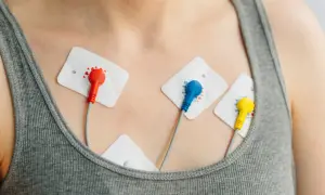 Elektrody EKG na klatce piersiowej, monitorujące pracę serca pod kątem arytmii.