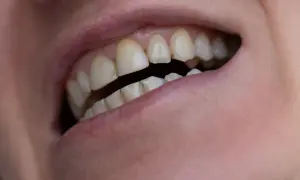 Zbliżenie na usta i zęby. Widać wyraźnie górne i dolne zęby, niektóre lekko przebarwione. Czy kazdy ma 8 zębów? To pytanie nurtuje wielu.