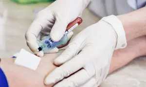 Czy badania krwi wykryją raka? Fakty i ograniczenia diagnostyki