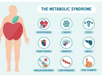 Ilustracja przedstawia zespół metaboliczny i jego powiązane schorzenia: nadciśnienie, choroby serca, insulinooporność, raka, demencję, problemy z lipidami, PCOS i cukrzycę typu 2.