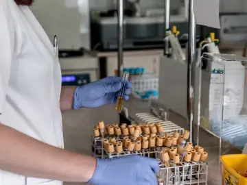 Laborantka w niebieskich rękawiczkach analizuje próbkę, która może zawierać dane o poziomie dehydrogenazy mleczanowej.