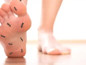 Mrówki na stopie symbolizują mrowienie i drętwienie, objawy neuropatii cukrzycowej.