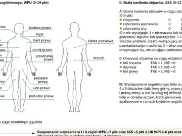 Schemat przedstawia lokalizację bólu w fibromialgii. Co to jest fibromialgia? To zespół objawów, m.in. bólu, zmęczenia, zaburzeń snu.