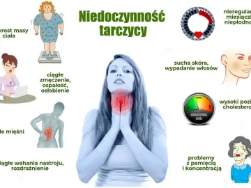 Objawy niedoczynności tarczycy: przyrost masy ciała, zmęczenie, bóle mięśni, wahania nastroju, sucha skóra, wypadanie włosów, problemy z pamięcią. Jakie badania na tarczycę wykonać?