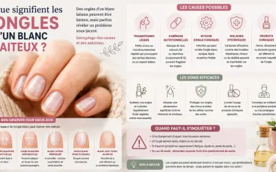 Ongles d'un blanc laiteux : causes possibles (traumatismes, carences, mycoses, maladies, produits chimiques) et soins.