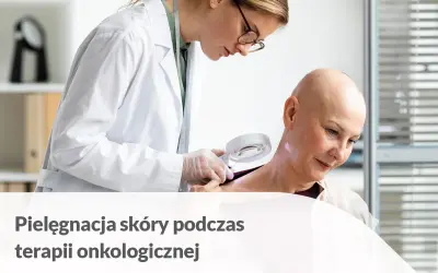Lekarka bada skórę pacjentki zmagającej się z chorobą nowotworową. Dbałość o skórę podczas radioterapii jest kluczowa.