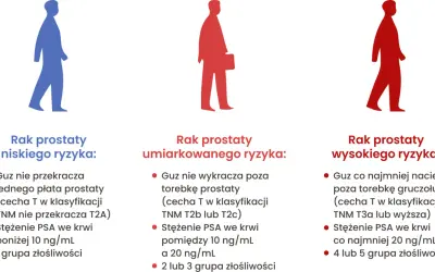 Ilustracja pokazuje trzy sylwetki mężczyzn, symbolizujące różne stadia raka prostaty: niskiego, umiarkowanego i wysokiego ryzyka. Opisuje, jak wygląda badanie prostaty w zależności od stopnia zaawansowania.