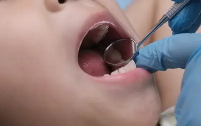 Esame dentistico: un piccolo specchietto riflette la bocca aperta di un bambino, mostrando la lingua e alcuni puntini sul palato.