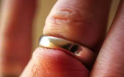Zbliżenie na palec z obrączką, która jest mocno osadzona.