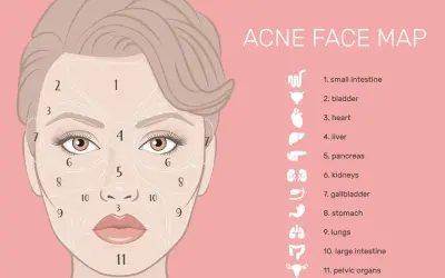 Mappa del viso per l'acne: la zona 3, intorno alla bocca, è collegata agli organi pelvici.