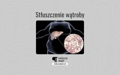 Stłuszczenie wątroby: powiększona wątroba z widocznym nagromadzeniem lipidów w komórkach.