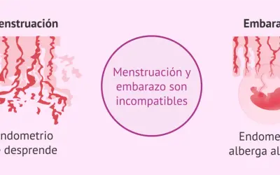 Ilustración compara menstruación (endometrio se desprende) y embarazo (endometrio alberga al bebé). Menstruación y embarazo son incompatibles.
