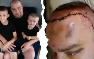 Ojciec z synami i blizna po operacji mózgu. Historia o tym, jak się umiera na glejaka, pokazuje walkę o życie.