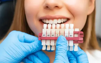 Uśmiechnięta kobieta z paletą odcieni zębów. Dentysta w niebieskich rękawiczkach dobiera kolor do wybielania zębów.