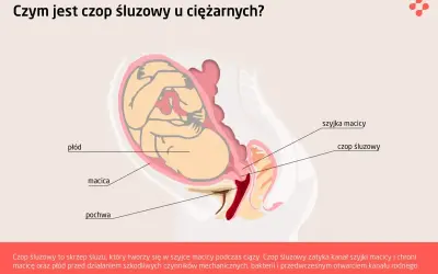 Ilustracja przedstawia przekrój przez ciążową macicę z płodem. Widoczny jest czop śluzowy zamykający szyjkę macicy.