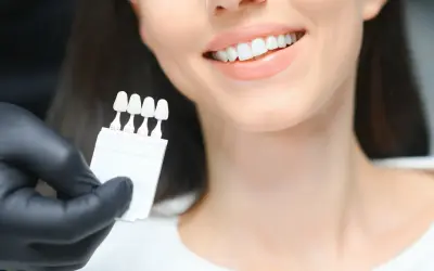 Ile kosztuje wybielenie zębów u dentysty? Sprawdź ceny i metody
