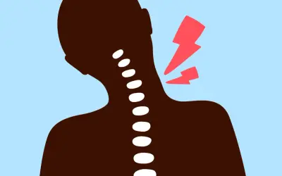 Silhouette d'une personne souffrant d'un torticolis chaud ou froid, avec des éclairs rouges symbolisant la douleur au niveau du cou.