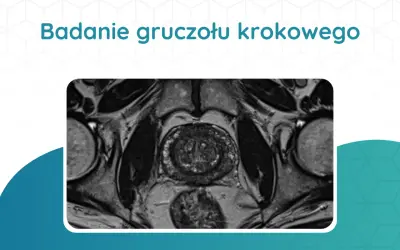 Tomografia prostaty: przekrój przez miednicę ukazujący gruczoł krokowy, pęcherz moczowy i inne struktury.