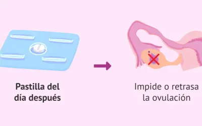 Pastilla del día después: su efecto es impedir o retrasar la ovulación, lo que puede afectar tu ciclo menstrual.