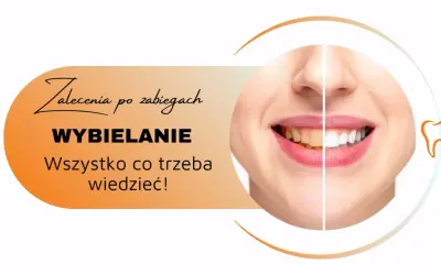 Zalecenia po zabiegach wybielania zębów. Uśmiech przed i po, by cieszyć się olśniewającą bielą.