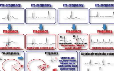 EKG w ciąży: kiedy jest konieczne i co musisz wiedzieć?