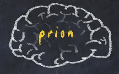 Szkic mózgu na tablicy, w środku żółty napis "priony".