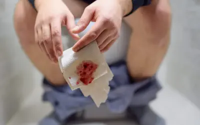 Dłoń trzymająca papier toaletowy z widocznymi skrzepami krwi w kale.