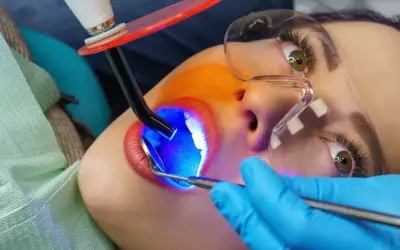 Zabieg lakowania zębów uśmiechniętej pacjentki. Dentysta używa lampy polimeryzacyjnej do utwardzenia materiału.