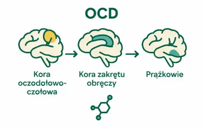 Schemat mózgu ilustrujący zaburzenia obsesyjno-kompulsyjne (OCD). Pokazuje zmiany w korze oczodołowo-czołowej, korze zakrętu obręczy i jądrach podstawy.