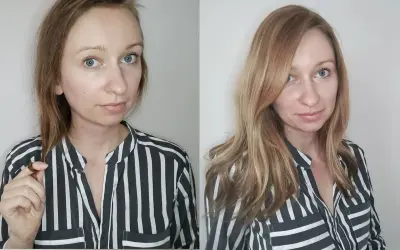 Vorher/Nachher-Vergleich: Frau mit dünnem Haar und dann vollerem, glänzenderem Haar. Hilft wirklich bei Haarausfall bei Frauen.