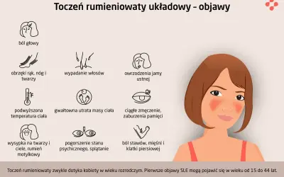 Grafika przedstawia objawy tocznia rumieniowatego układowego (SLE): ból głowy, obrzęki, wypadanie włosów, owrzodzenia jamy ustnej, gorączkę, utratę wagi, zmęczenie, wysypkę motylkową, problemy psychiczne i bóle stawów.