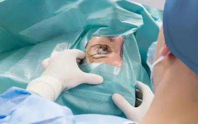 Oko pacjenta podczas zabiegu laserowej korekcji wzroku, przygotowywane przez chirurga w rękawiczkach.